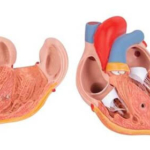 coração-clássico-com-hipertrofia-ventricular-esquerda-2-partes-6