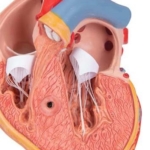 coração-clássico-com-hipertrofia-ventricular-esquerda-2-partes-7